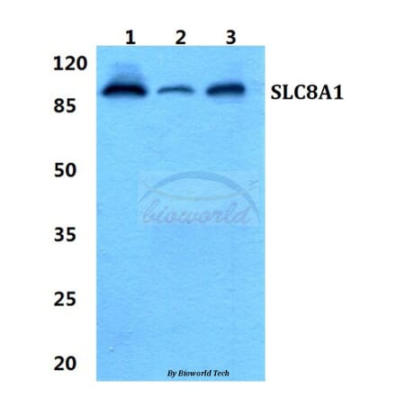 Anti-SLC8A1 Antibody from Bioworld Technology (BS5816) - Antibodies.com