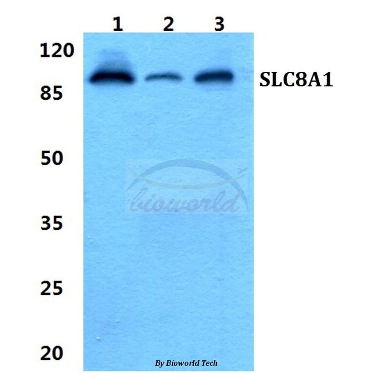 Anti-SLC8A1 Antibody from Bioworld Technology (BS5816) - Antibodies.com