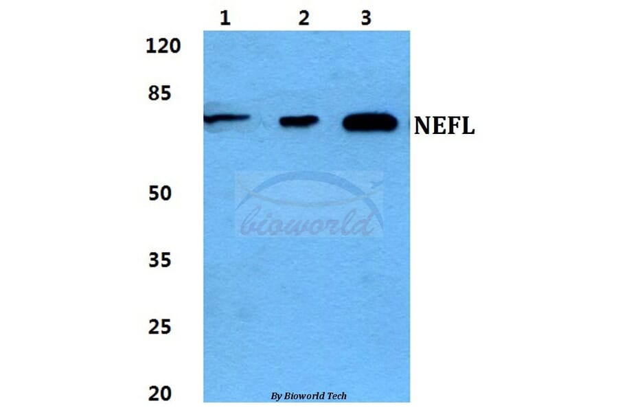 Anti-NEFL Antibody from Bioworld Technology (BS5822) - Antibodies.com