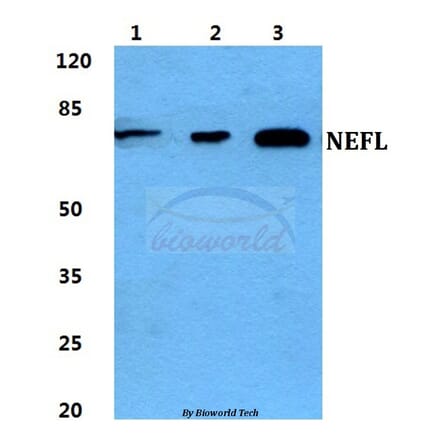 Anti-NEFL Antibody from Bioworld Technology (BS5822) - Antibodies.com