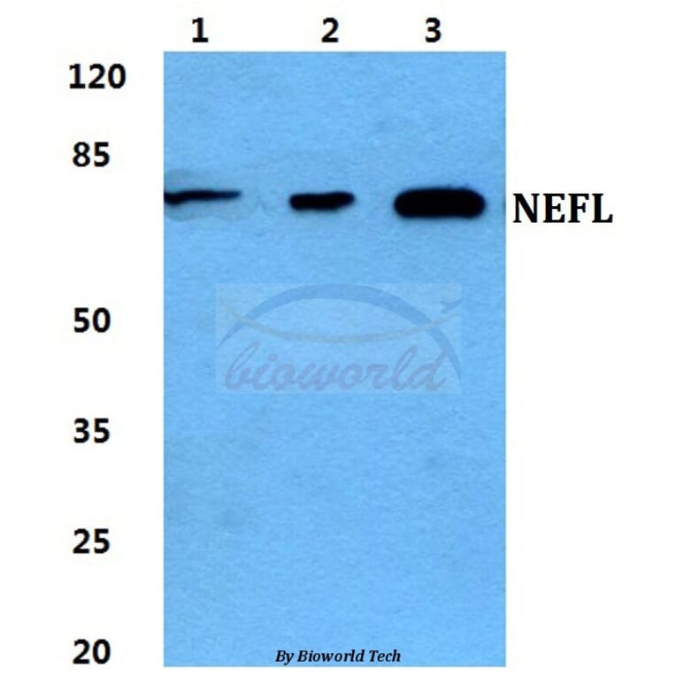 Anti-NEFL Antibody from Bioworld Technology (BS5822) - Antibodies.com