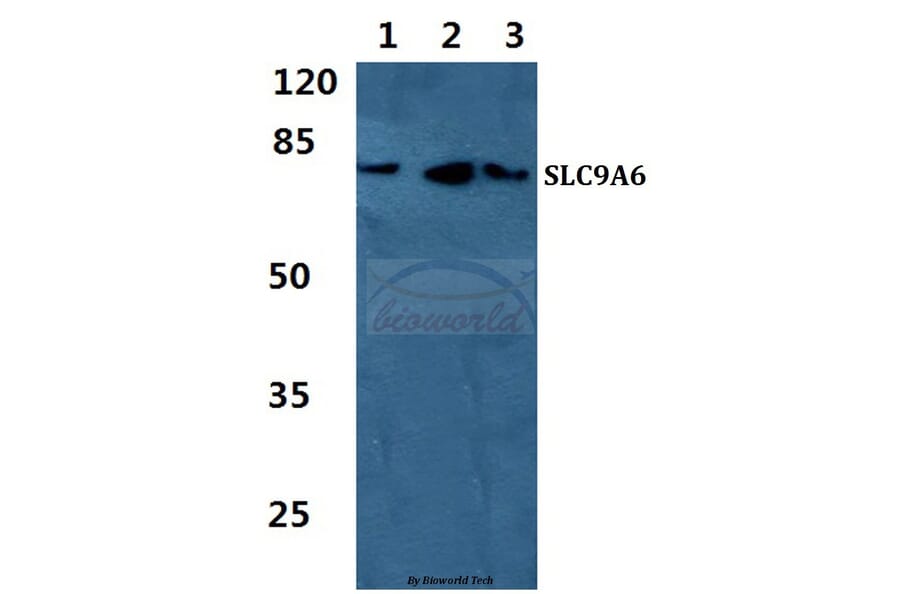 Anti-SLC9A6 Antibody from Bioworld Technology (BS5823) - Antibodies.com