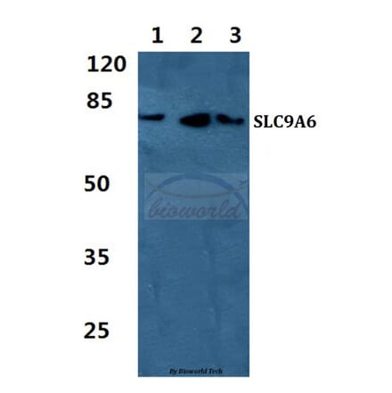 Anti-SLC9A6 Antibody from Bioworld Technology (BS5823) - Antibodies.com