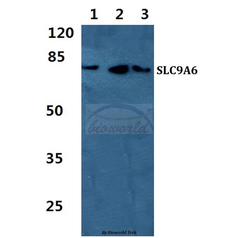 Anti-SLC9A6 Antibody from Bioworld Technology (BS5823) - Antibodies.com