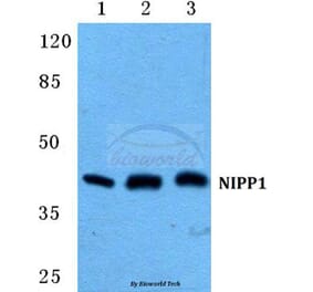 Anti-NIPP1 Antibody from Bioworld Technology (BS5825) - Antibodies.com