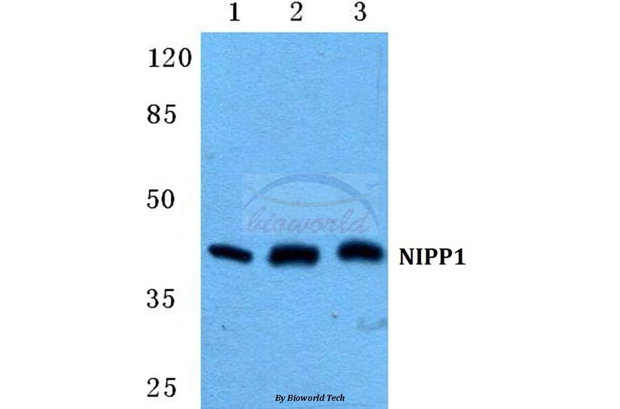 Anti-NIPP1 Antibody from Bioworld Technology (BS5825) - Antibodies.com