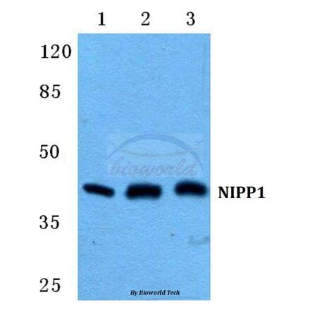 Anti-NIPP1 Antibody from Bioworld Technology (BS5825) - Antibodies.com