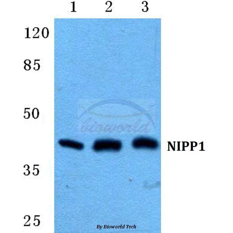 Anti-NIPP1 Antibody from Bioworld Technology (BS5825) - Antibodies.com