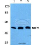 Anti-NIPP1 Antibody from Bioworld Technology (BS5825) - Antibodies.com