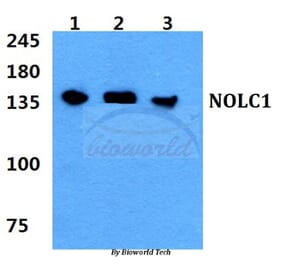 Anti-NOLC1 Antibody from Bioworld Technology (BS5826) - Antibodies.com