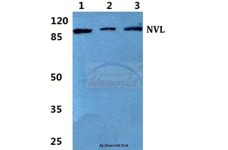 Anti-NVL Antibody from Bioworld Technology (BS5832) - Antibodies.com