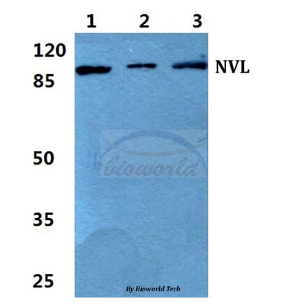 Anti-NVL Antibody from Bioworld Technology (BS5832) - Antibodies.com