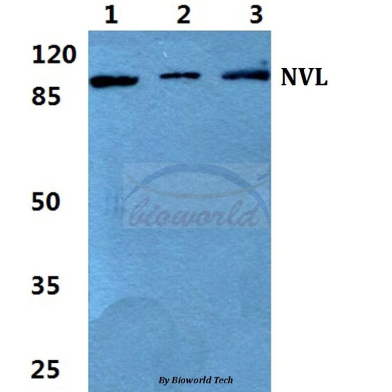 Anti-NVL Antibody from Bioworld Technology (BS5832) - Antibodies.com
