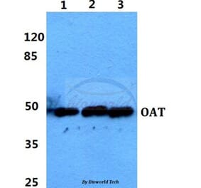 Anti-OAT Antibody from Bioworld Technology (BS5833) - Antibodies.com