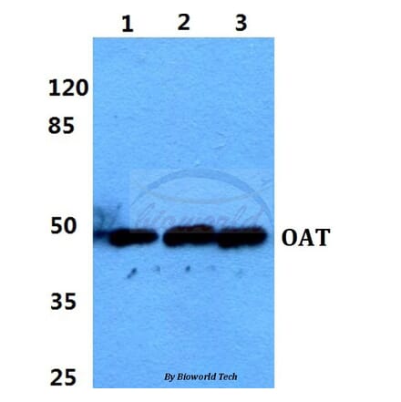 Anti-OAT Antibody from Bioworld Technology (BS5833) - Antibodies.com