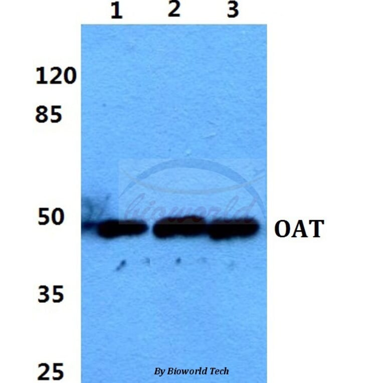 Anti-OAT Antibody from Bioworld Technology (BS5833) - Antibodies.com