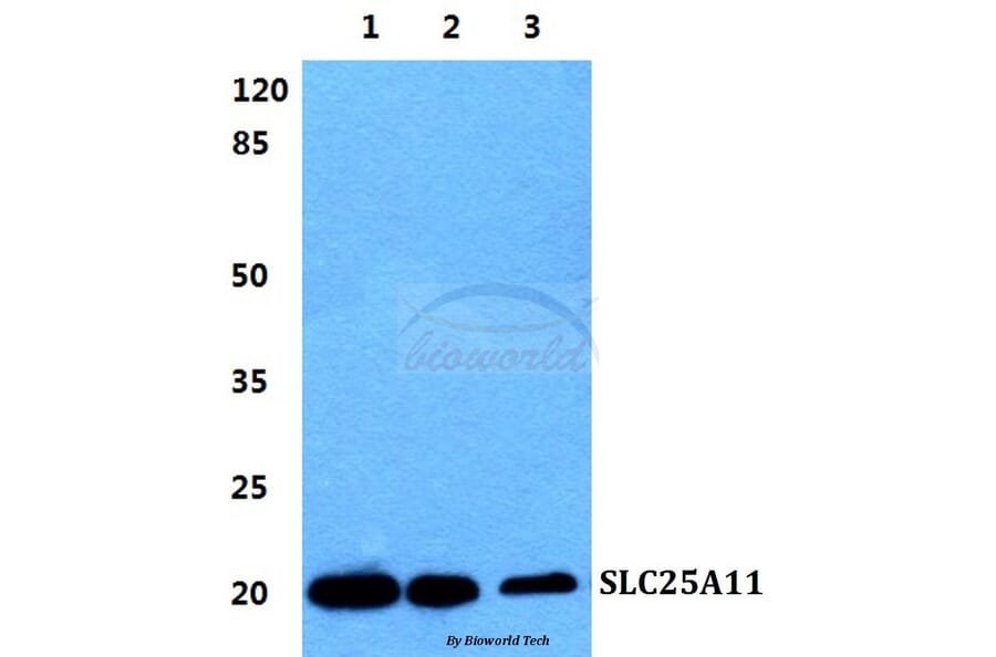 Anti-SLC25A11 Antibody from Bioworld Technology (BS5834) - Antibodies.com