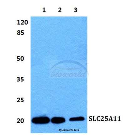 Anti-SLC25A11 Antibody from Bioworld Technology (BS5834) - Antibodies.com