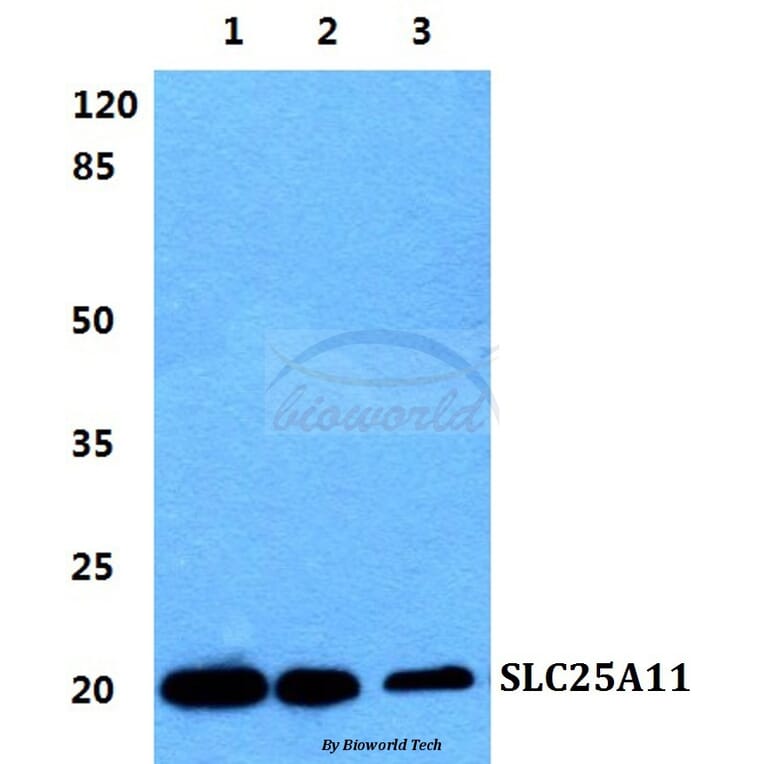 Anti-SLC25A11 Antibody from Bioworld Technology (BS5834) - Antibodies.com