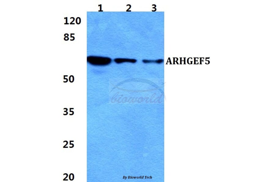 Anti-ARHGEF5 Antibody from Bioworld Technology (BS5835) - Antibodies.com