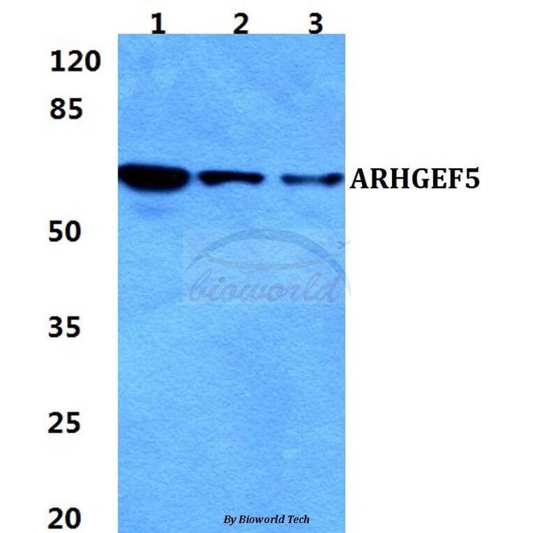 Anti-ARHGEF5 Antibody from Bioworld Technology (BS5835) - Antibodies.com