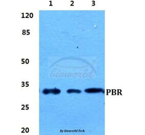 Anti-PBR Antibody from Bioworld Technology (BS5840) - Antibodies.com