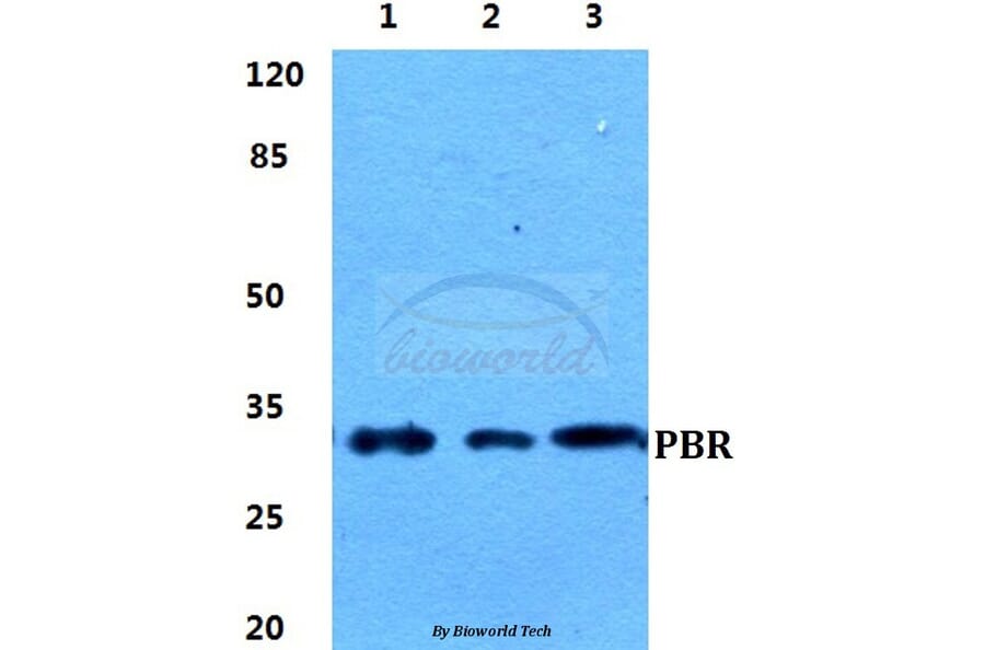 Anti-PBR Antibody from Bioworld Technology (BS5840) - Antibodies.com
