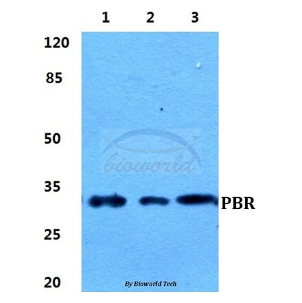 Anti-PBR Antibody from Bioworld Technology (BS5840) - Antibodies.com