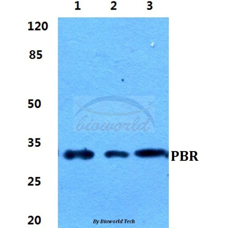 Anti-PBR Antibody from Bioworld Technology (BS5840) - Antibodies.com