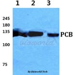 Anti-PCB Antibody from Bioworld Technology (BS5841) - Antibodies.com