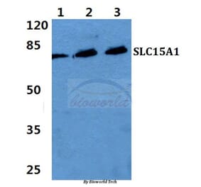 Anti-SLC15A1 Antibody from Bioworld Technology (BS5847) - Antibodies.com