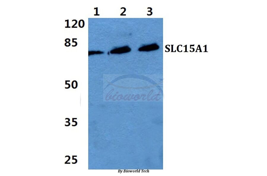 Anti-SLC15A1 Antibody from Bioworld Technology (BS5847) - Antibodies.com