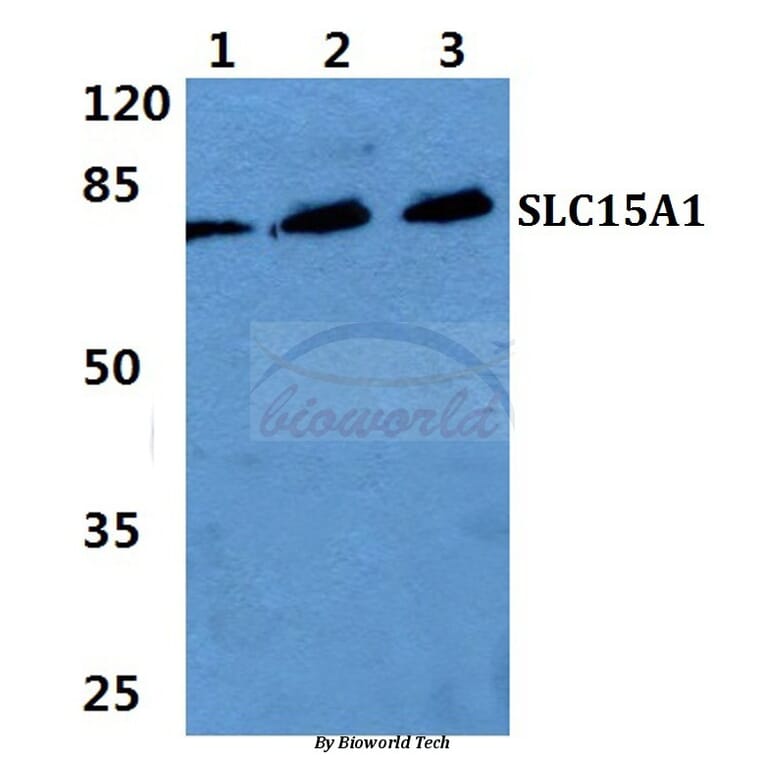 Anti-SLC15A1 Antibody from Bioworld Technology (BS5847) - Antibodies.com