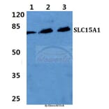 Anti-SLC15A1 Antibody from Bioworld Technology (BS5847) - Antibodies.com