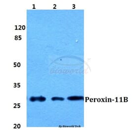 Anti-Peroxin-11B Antibody from Bioworld Technology (BS5848) - Antibodies.com