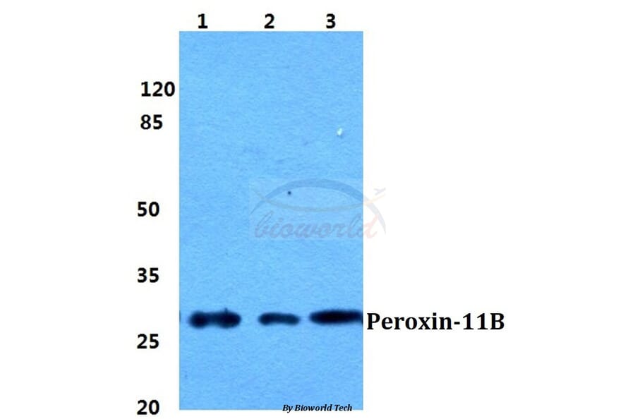 Anti-Peroxin-11B Antibody from Bioworld Technology (BS5848) - Antibodies.com