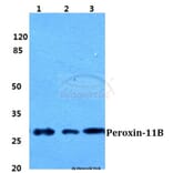 Anti-Peroxin-11B Antibody from Bioworld Technology (BS5848) - Antibodies.com