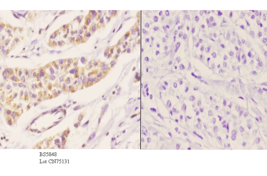 Anti-Peroxin-11B Antibody from Bioworld Technology (BS5848) - Antibodies.com