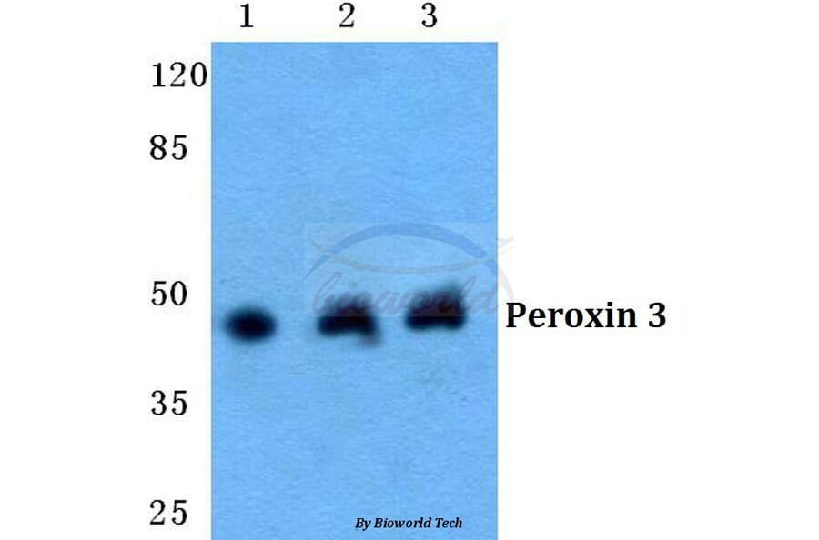 Anti-Peroxin 3 Antibody from Bioworld Technology (BS5849) - Antibodies.com