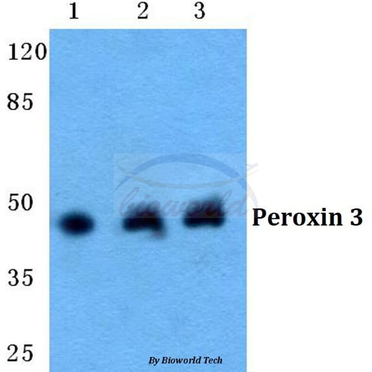Anti-Peroxin 3 Antibody from Bioworld Technology (BS5849) - Antibodies.com