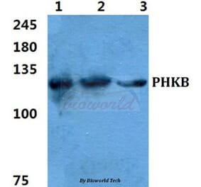 Anti-PHKB Antibody from Bioworld Technology (BS5854) - Antibodies.com