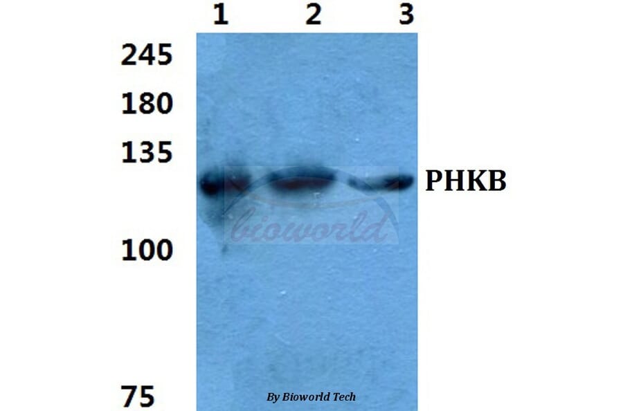 Anti-PHKB Antibody from Bioworld Technology (BS5854) - Antibodies.com