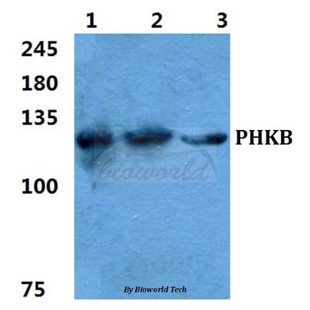 Anti-PHKB Antibody from Bioworld Technology (BS5854) - Antibodies.com