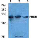 Anti-PHKB Antibody from Bioworld Technology (BS5854) - Antibodies.com