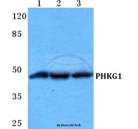 Anti-PHKG1 Antibody from Bioworld Technology (BS5855) - Antibodies.com