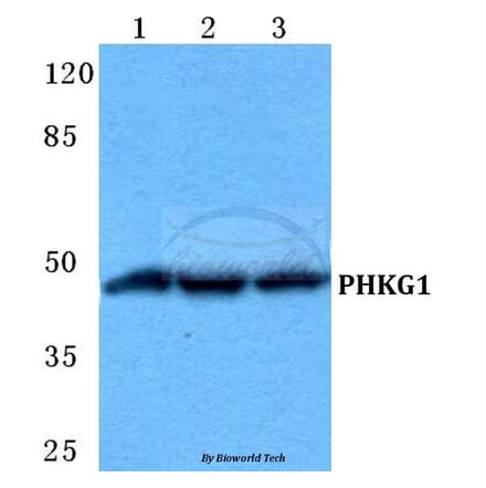 Anti-PHKG1 Antibody from Bioworld Technology (BS5855) - Antibodies.com