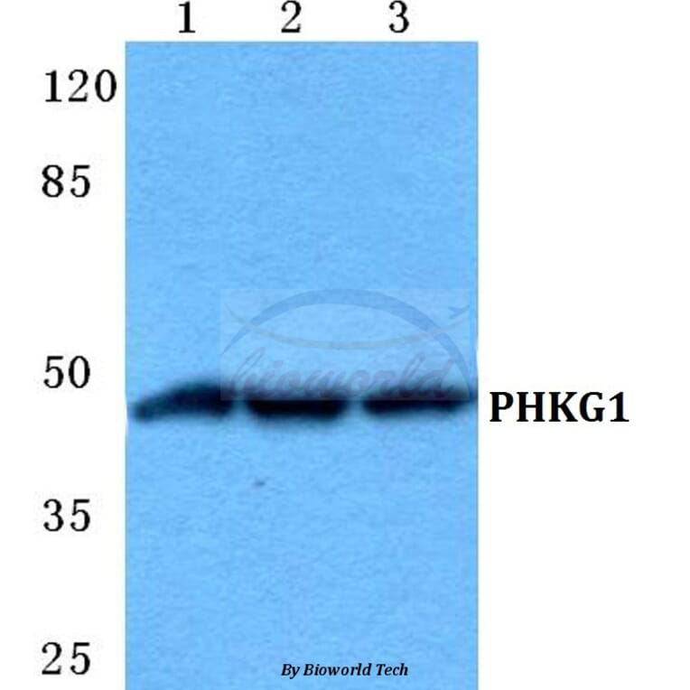 Anti-PHKG1 Antibody from Bioworld Technology (BS5855) - Antibodies.com