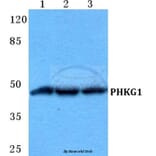 Anti-PHKG1 Antibody from Bioworld Technology (BS5855) - Antibodies.com