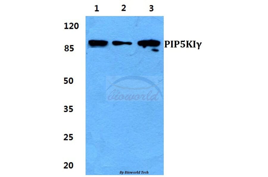 Anti-PIP5KIγ Antibody from Bioworld Technology (BS5857) - Antibodies.com