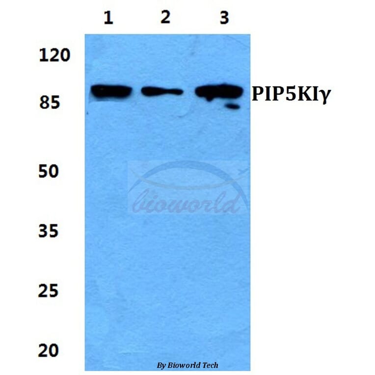 Anti-PIP5KIγ Antibody from Bioworld Technology (BS5857) - Antibodies.com